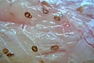 Presencia De Anisakis En La Merluza